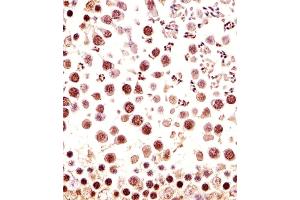 Immunohistochemical analysis of paraffin-embedded M.