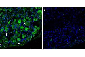 Expression of LAT1/SLC7A5 in rat dorsal root ganglion.