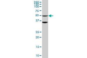 Western Blotting (WB) image for anti-serine/threonine Kinase 40 (STK40) (AA 349-435) antibody (ABIN599597) (STK40 anticorps  (AA 349-435))