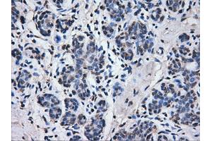 Immunohistochemical staining of paraffin-embedded breast tissue using anti-ATP5B mouse monoclonal antibody. (ATP5B anticorps)