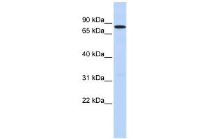 WB Suggested Anti-DDX41 Antibody Titration:  0. (DDX41 anticorps  (N-Term))
