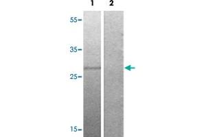 Western blot analysis of Lane 1: serum treated HepG2 cells, Lane 2: antigen-specific peptide treated HepG2 cells with OXSR1 (phospho T185) polyclonal antibody  at 1:500-1000 dilution.