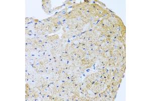 Immunohistochemistry of paraffin-embedded mouse heart using STC1 antibody (ABIN5975425) at dilution of 1/100 (40x lens). (Stanniocalcin 1 anticorps)