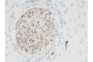 Image no. 1 for anti-Galectin 3 (LGALS3) antibody (ABIN464873) (Galectin 3 anticorps)