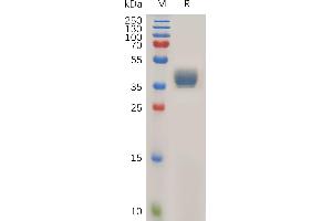 Human Protein, hFc Tag on SDS-PAGE under reducing condition.