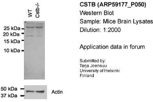 Western Blotting (WB) image for anti-Cystatin B (Stefin B) (CSTB) (N-Term) antibody (ABIN2787965)