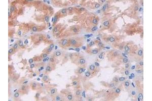 Detection of PIK3Cb in Human Kidney Tissue using Polyclonal Antibody to Phosphoinositide-3-Kinase Catalytic Beta Polypeptide (PIK3Cb)