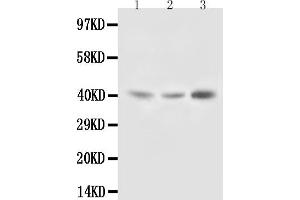 Anti-Decorin antibody, Western blotting Lane 1: Rat Liver Tissue Lysate Lane 2: Rat Kidney Tissue Lysate Lane 3: SMMC Cell Lysate
