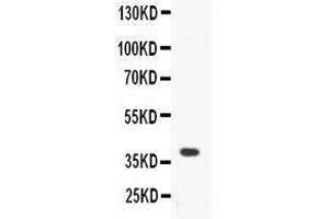 Western blot analysis of CD40/TNFRSF5 expression in mouse spleen extract ( Lane 1). (CD40 anticorps  (AA 20-193))