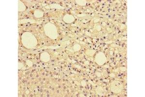 Immunohistochemistry of paraffin-embedded human adrenal gland tissue using ABIN7148417 at dilution of 1:100 (NDUFAF1 anticorps  (AA 25-327))