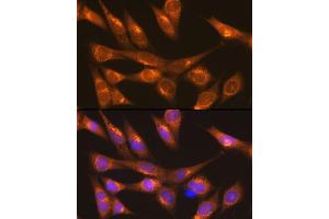 Immunofluorescence analysis of NIH-3T3 cells using LM Rabbit pAb (ABIN6131613, ABIN6143266, ABIN6143267 and ABIN6214694) at dilution of 1:100 (40x lens).