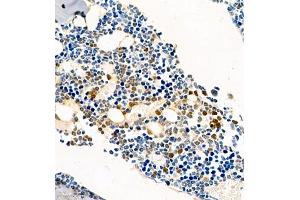 Immunohistochemistry of paraffin embedded mouse bone using CSF1 (ABIN7073553) at dilution of 1:450 (400x lens) (M-CSF/CSF1 anticorps)