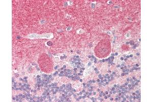 Human Brain, Cerebellum: Formalin-Fixed, Paraffin-Embedded (FFPE).