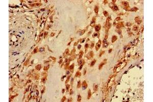 Immunohistochemistry of paraffin-embedded human placenta tissue using ABIN7163206 at dilution of 1:100 (PIGA anticorps  (AA 443-484))