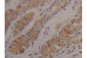 DAB staining on IHC-P; Samples: Human Stomach Tissue