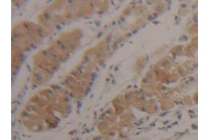 DAB staining on IHC-P; Samples: Human Stomach Tissue (SUOX anticorps  (AA 80-545))