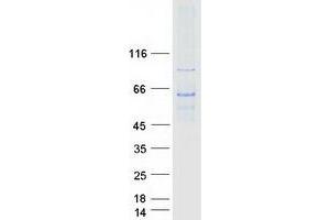 Validation with Western Blot