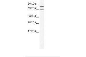 Image no. 1 for anti-Poly A Specific Ribonuclease (PARN) (N-Term) antibody (ABIN202834) (PARN anticorps  (N-Term))