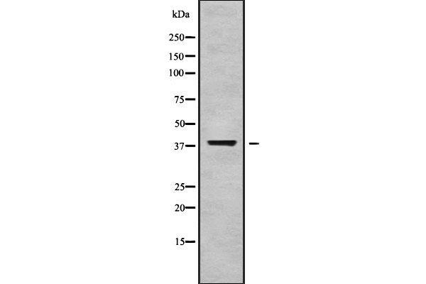GALM anticorps  (C-Term)