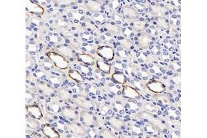 Immunohistochemistry analysis of paraffin-embedded rat kidney using,SLC6A8 (ABIN7075678) at dilution of 1: 400
