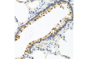 Immunohistochemistry of paraffin-embedded rat lung using CST4 antibody at dilution of 1:100 (40x lens).