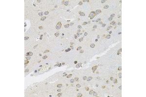 Immunohistochemistry of paraffin-embedded mouse brain using VEPH1 antibody. (VEPH1 anticorps  (AA 448-547))