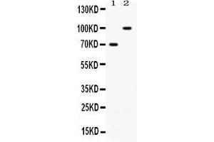 Western blot analysis of ZP1 expression in rat ovary extract ( Lane 1) and SKOV3 whole cell lysates ( Lane 2).