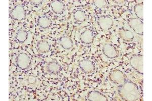 anti-Mitochondrial Ribosomal Protein L49 (MRPL49) (AA 1-166) antibody