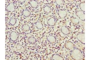 Immunohistochemistry of paraffin-embedded human colon tissue using ABIN7142431 at dilution of 1:100 (MRPL49 anticorps  (AA 1-166))