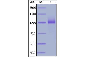 Biotinylated Human IL-12 R beta 1, Fc,Avitag on  under reducing (R) condition.