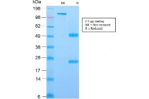 SDS-PAGE Analysis Purified YBX1 Mouse Recombinant Monoclonal Antibody (rYBX1/2430). (Recombinant YBX1 anticorps)