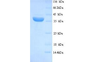 SDS-PAGE (SDS) image for Melanoma Antigen Family A, 1 (Directs Expression of Antigen MZ2-E) (MAGEA1) (AA 1-309), (full length) protein (His tag) (ABIN5713624) (MAGEA1 Protein (AA 1-309, full length) (His tag))