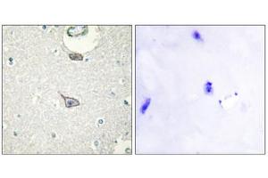 Immunohistochemistry analysis of paraffin-embedded human brain tissue using CADM4 antibody. (Cell Adhesion Molecule 4 anticorps  (C-Term))