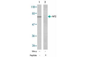 Western blot analysis of extracts from 293 cells untreated or treated with IFN-alpha (100 ng/mL, 15 min) using NF2 polyclonal antibody . (Merlin anticorps)