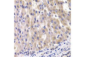 Immunohistochemistry of paraffin-embedded rat liver using RPL14 antibody at dilution of 1:100 (x400 lens). (RPL14 anticorps)