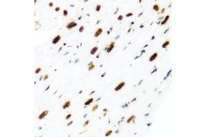 Immunohistochemistry of paraffin-embedded rat heart using H2AFX antibody (ABIN5997870) at dilution of 1/100 (40x lens). (H2AFX anticorps)