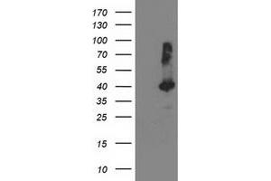 Western Blotting (WB) image for anti-TBC1 Domain Family, Member 21 (TBC1D21) antibody (ABIN1501318) (TBC1D21 anticorps)