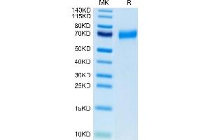 Biotinylated Human CLEC12A/MICL/CLL-1 on Tris-Bis PAGE under reduced condition. (CLEC12A Protein (AA 65-265) (Fc-Avi Tag,Biotin))