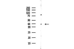 anti-Kruppel-Like Factor 3 (Basic) (KLF3) antibody