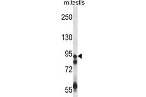 Western Blotting (WB) image for anti-Ubiquitin Specific Peptidase 20 (USP20) antibody (ABIN2998024)