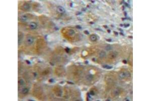 Used in DAB staining on fromalin fixed paraffin-embedded Liver tissue (CCL5 anticorps  (AA 24-91))