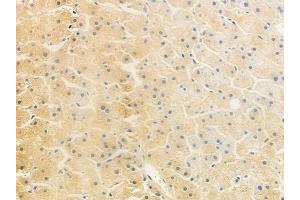 anti-ADAM Metallopeptidase Domain 8 (ADAM8) (Internal Region) antibody