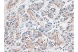 Detection of EZR in Human Pancreas Tissue using Polyclonal Antibody to Ezrin (EZR)