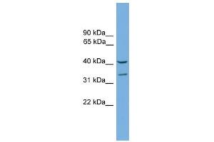WB Suggested Anti-Fkhl18 Antibody Titration:  0.