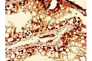 Immunohistochemistry of paraffin-embedded human testis tissue using ABIN7175942 at dilution of 1:100 (YTHDF2 anticorps  (AA 201-500))