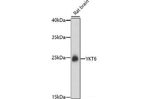 Western blot analysis of extracts of Rat brain using YKT6 Polyclonal Antibody at dilution of 1:1000.
