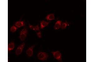 ABIN6275938 staining Hela by IF/ICC. (EMR3 anticorps  (C-Term))