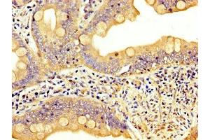 IHC image of ABIN7158430 diluted at 1:300 and staining in paraffin-embedded human small intestine tissue performed on a Leica BondTM system.