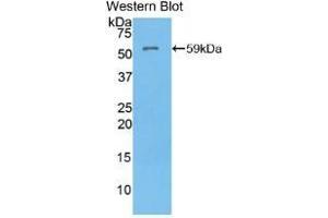 Detection of Recombinant ATP4a, Mouse using Polyclonal Antibody to ATPase, H+/K+ Exchanging Alpha Polypeptide (ATP4a)