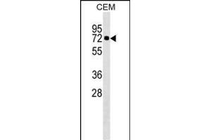 KLHL28 Antibody (C-term) (ABIN1537239 and ABIN2849863) western blot analysis in CEM cell line lysates (35 μg/lane). (KLHL28 anticorps  (C-Term))